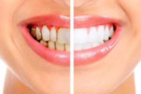 17327950951112706550