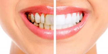 17327950951112706550