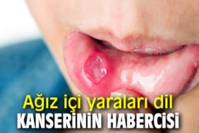 17342689362144352564