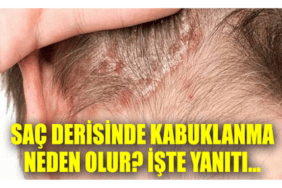 17361786401949324991