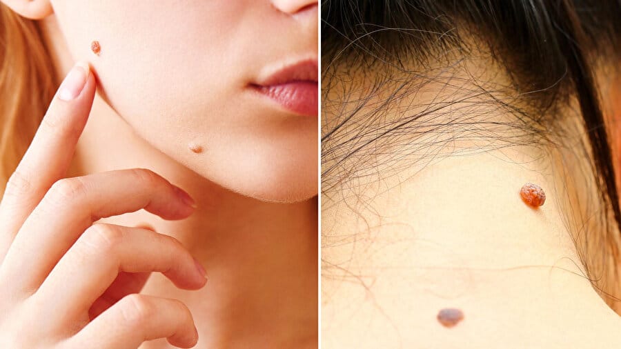 17488032871527555354