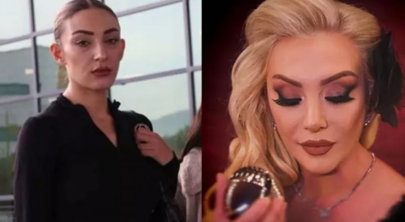 17663430151130056683