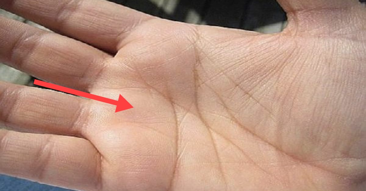 17768863621748482265