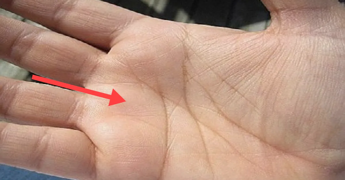 17768863621748482265